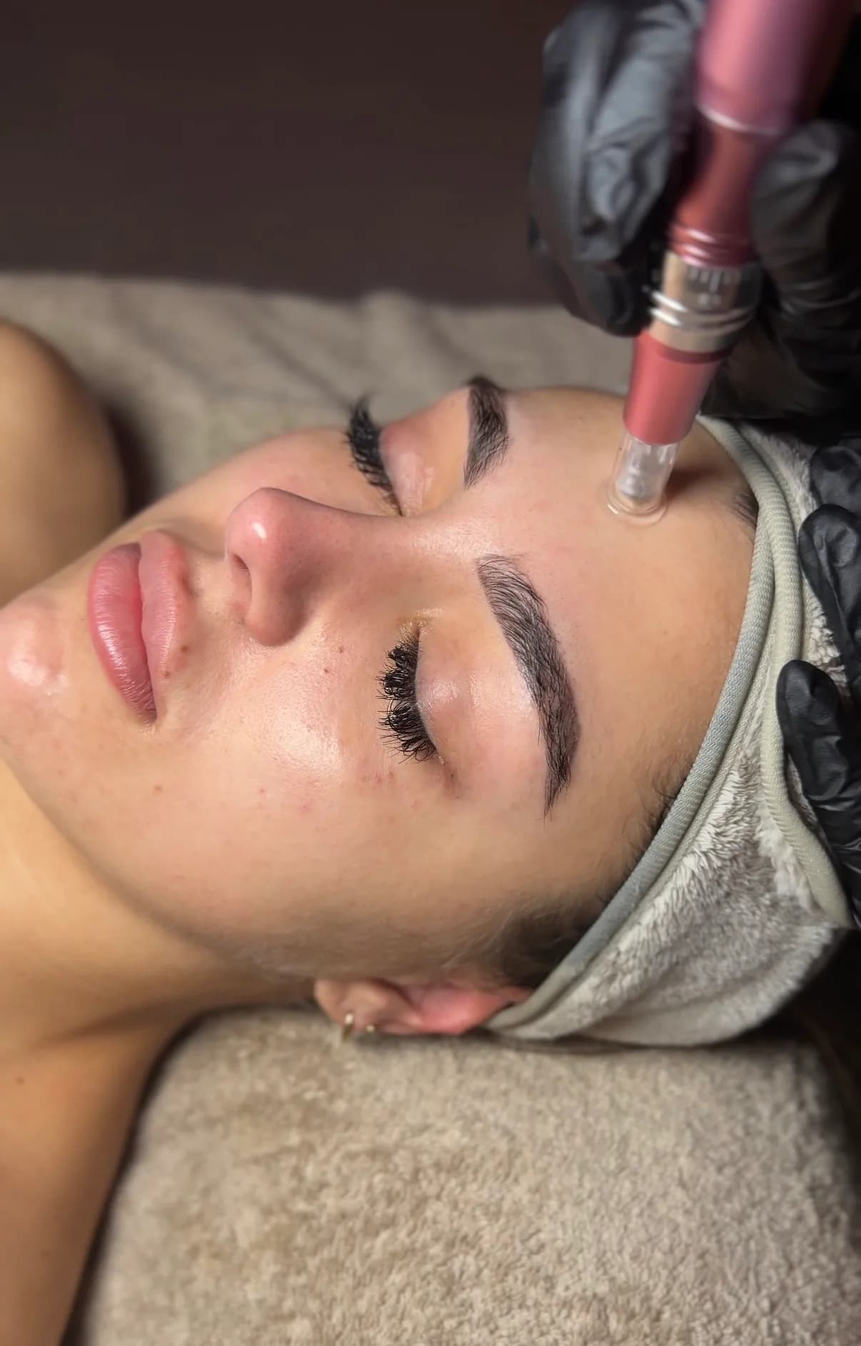Microneedling Head Spa Enschede